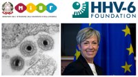 Sclerosi sistemica | Scoperta da Unife possibile associazione con l’Herpes virus umano 6