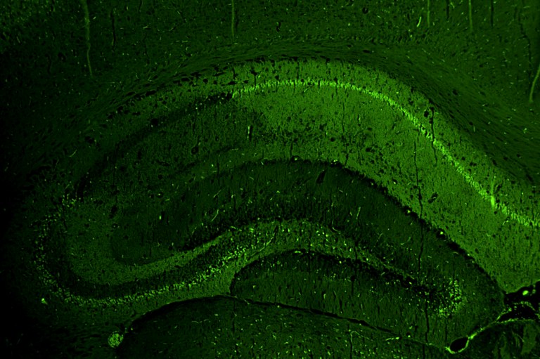 epilessia