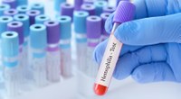 Mutazioni genetiche | Telethon finanzia ricerca sull’emofilia A
